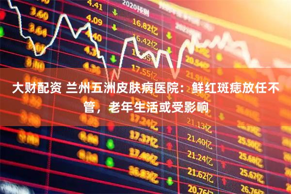 大财配资 兰州五洲皮肤病医院：鲜红斑痣放任不管，老年生活或受影响